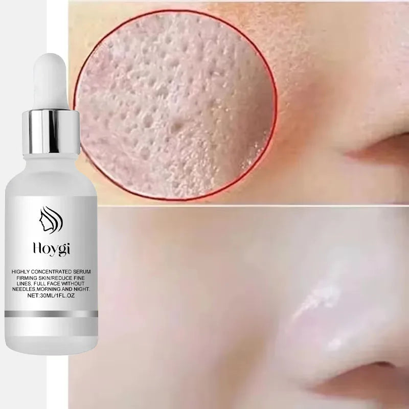 Korean Lactic Acid Large Pores Serum