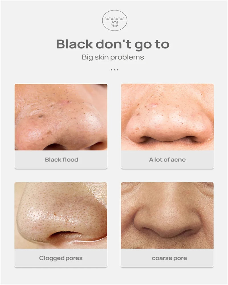 LANBENA Blackhead Peel-Off Nose Mask