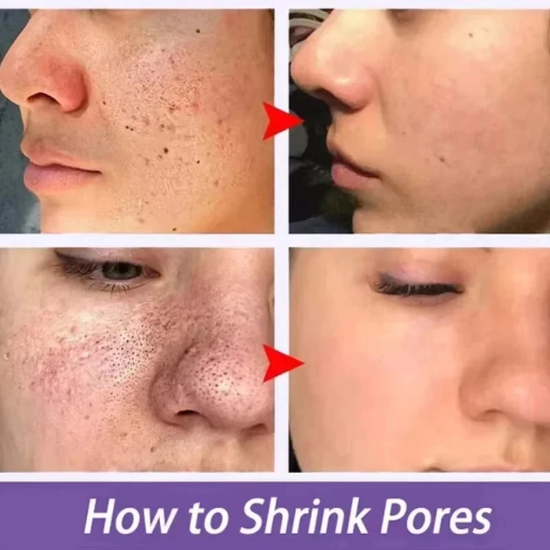 Korean Lactic Acid Large Pores Serum