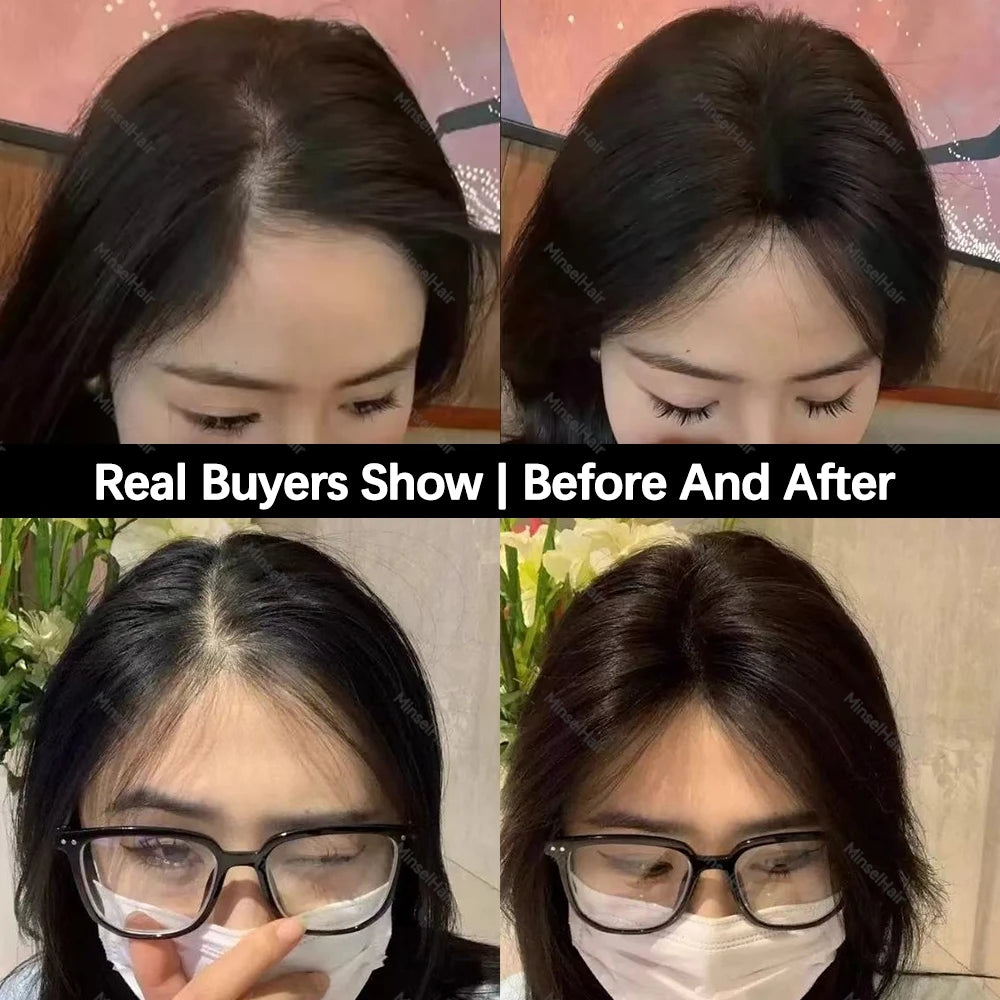 Comfortable No Clip Human Hair Toppers that transform thin hair into a full, stylish look.