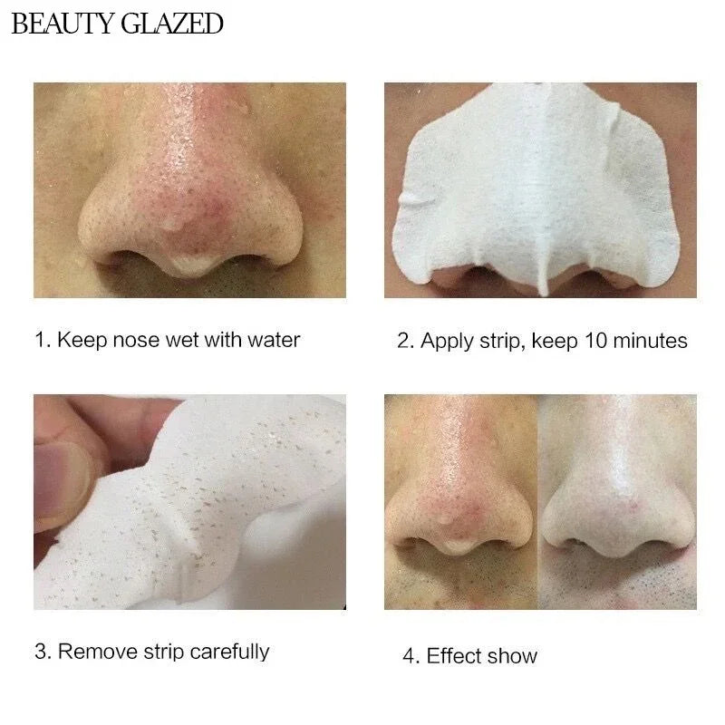 Application of 100PCS Premium Bamboo Charcoal Nose Strips on nose for blackhead removal.