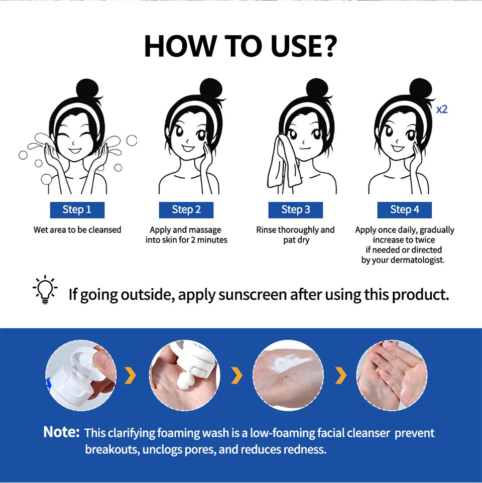 Benzoyl Peroxide 10% Acne Foaming Wash