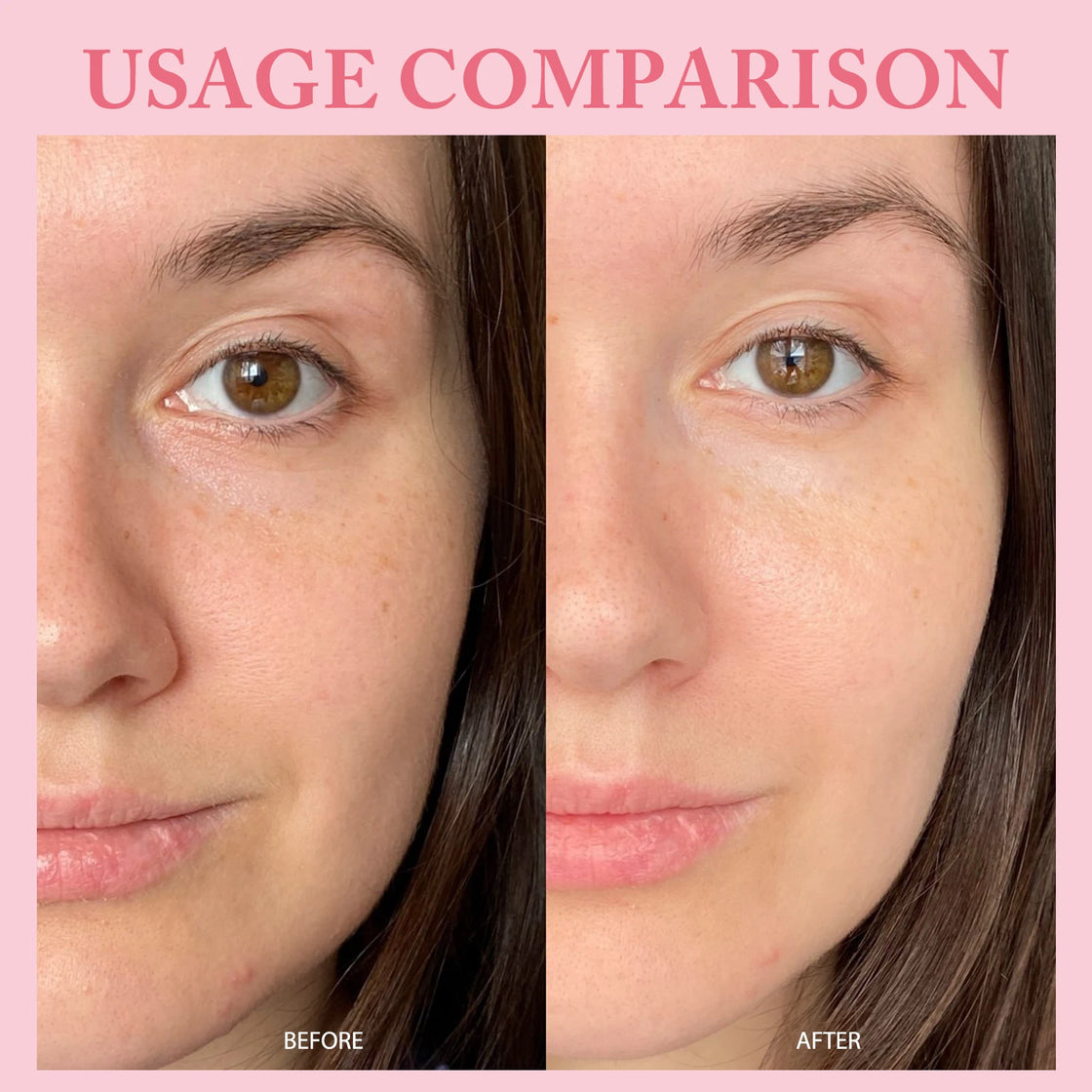 Close-up of PDRN Pink One Day Serum bottle, deep moisturizing serum for anti-aging effects.