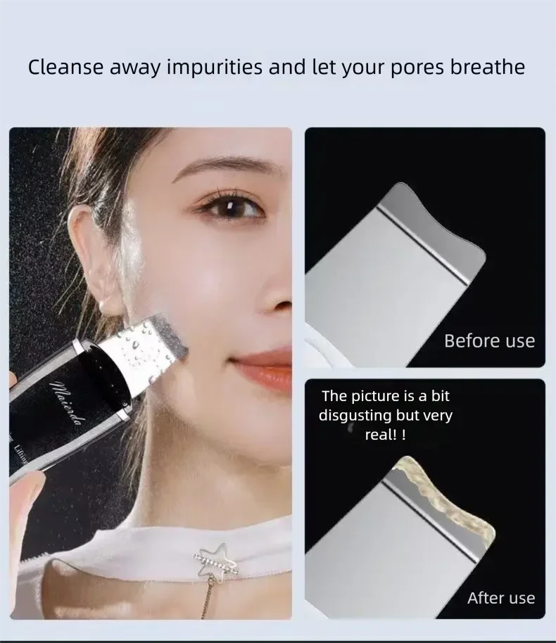 Ultrasonic Facial Skin Scraper