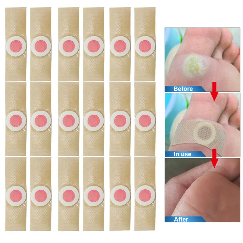 36PCS Foot Corn & Callus Pads